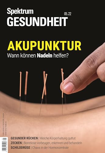 Spektrum Gesundheit- Akupunktur: Wann können Nadeln helfen? von Spektrum D. Wissenschaft